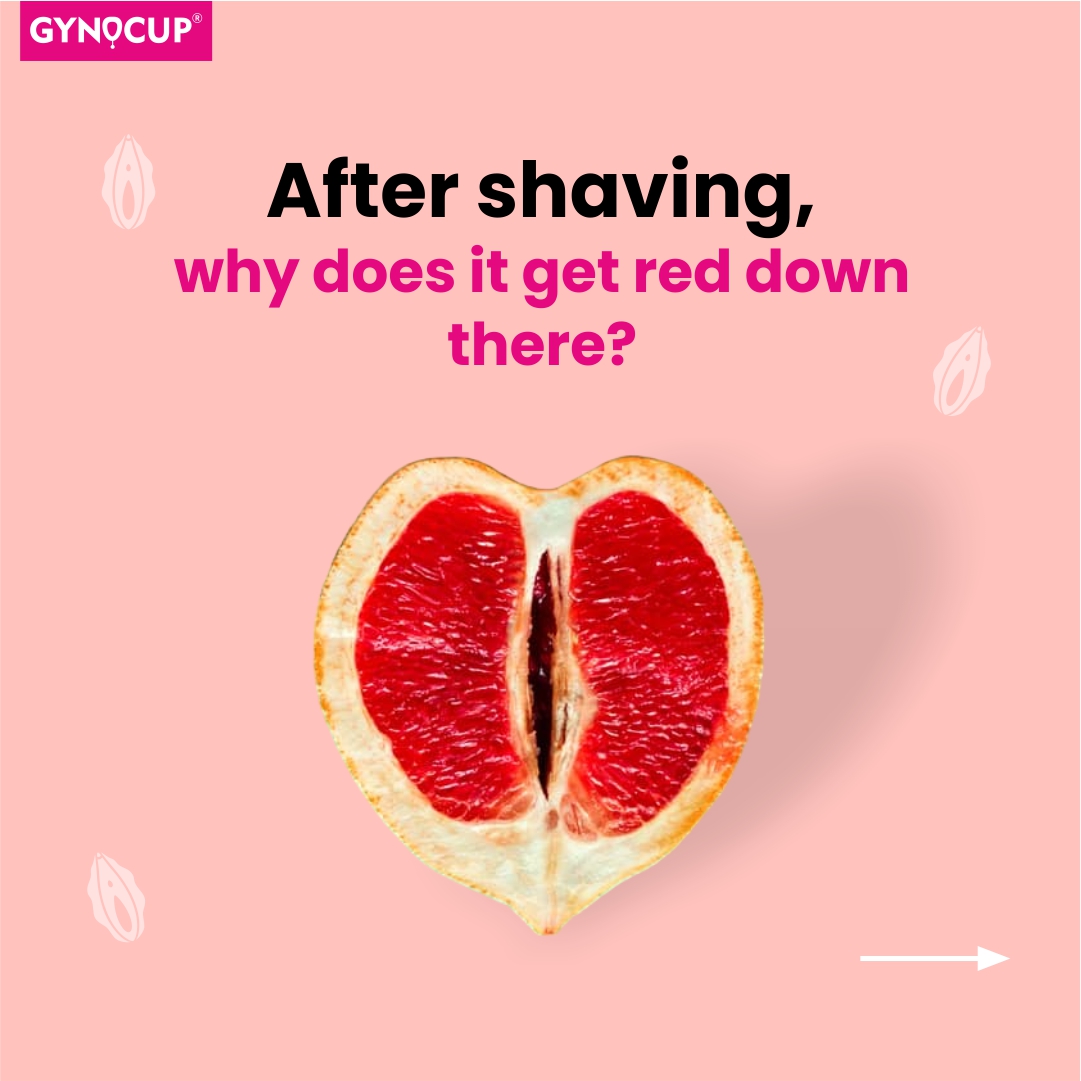 Post-shave redness occurs due to skin irritation; 
prevent it by using a sharp razor and soothing aftershave.

Shop Now: shorturl.at/iouD1

t #haircut #wetshaving #fade #beard #safetyrazor #shaveoftheday #sotd #wahl #mensgrooming #barbers #gynocup #mildcares'