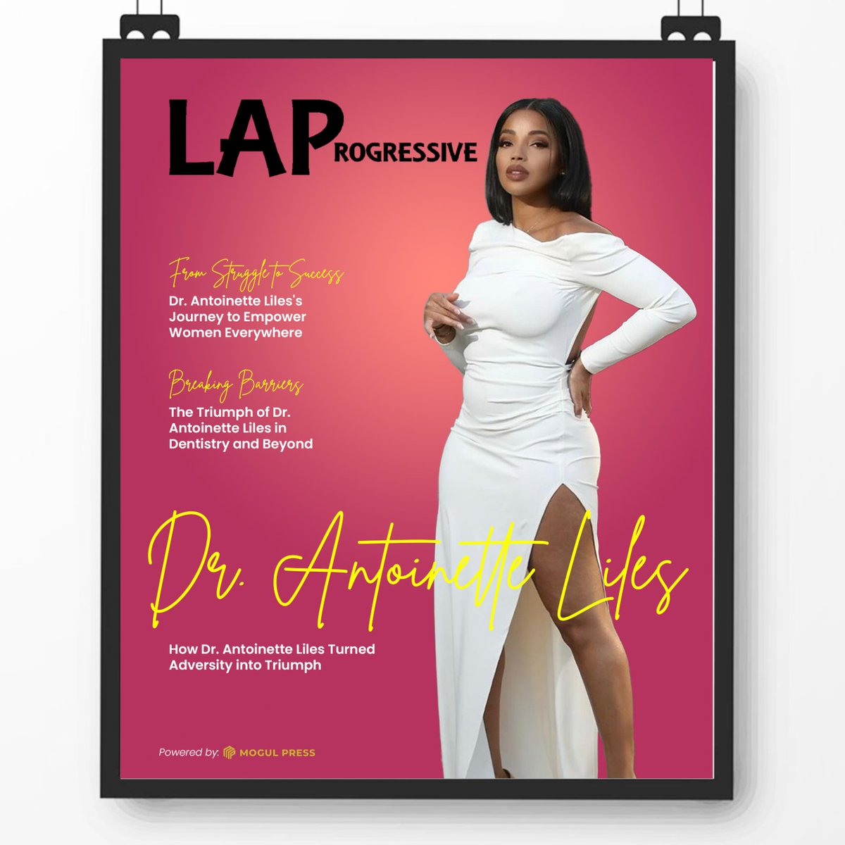Dr. Antoinette Liles's path from overcoming hardship to success encourages women everywhere to never accept anything less.

#mogulpress #Drantoinette #inspirationaltale #clientdiaries #communityleader #inspiringwomen #prsuccessstories
