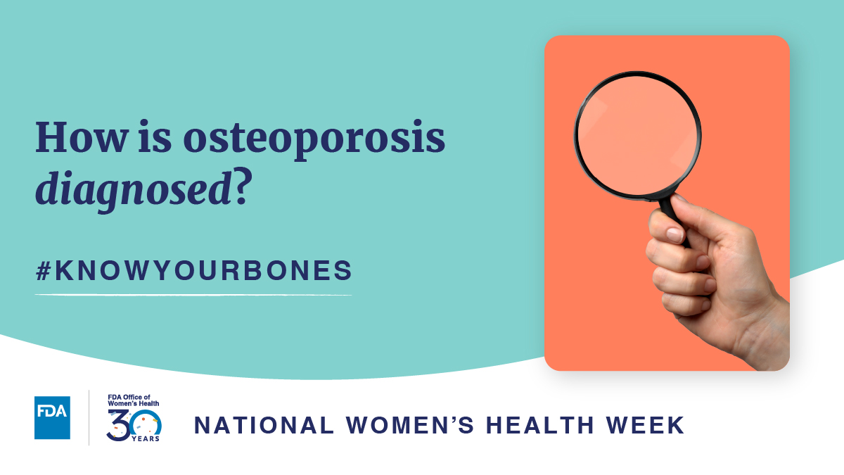 #Osteoporosis is a silent disease, meaning you may not even know you have it until you break a bone. Tests to help determine if you have osteoporosis are recommended for women at higher risk of developing osteoporosis and women older than 65. ow.ly/kCpq50RC8lO #NWHW2024