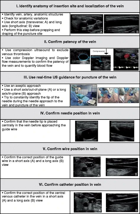 🔴Ultrasound-guided central venous catheter placement: a structured reviewand recommendations for clinical practice #openaccess ccforum.biomedcentral.com/articles/10.11… #medtwitterWhat #MedTwitter #CardioEd #medx #medEd #CardioTwitter #cardiotwitter #MedX #MedEd #cardiology #cardiotwiteros