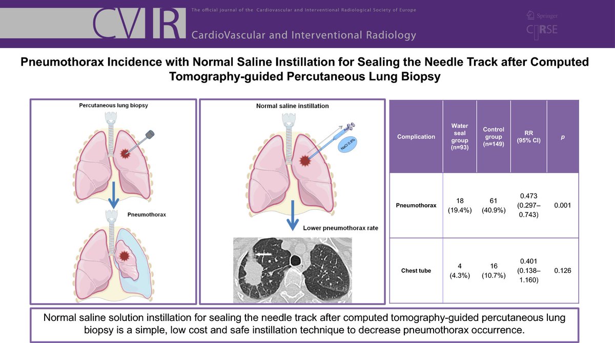 Read now in CVIR 📖 Pneumothorax Incidence with Normal Saline Instillation for Sealing the Needle Track After Computed Tomography-Guided Percutaneous #Lung Biopsy link.springer.com/article/10.100…