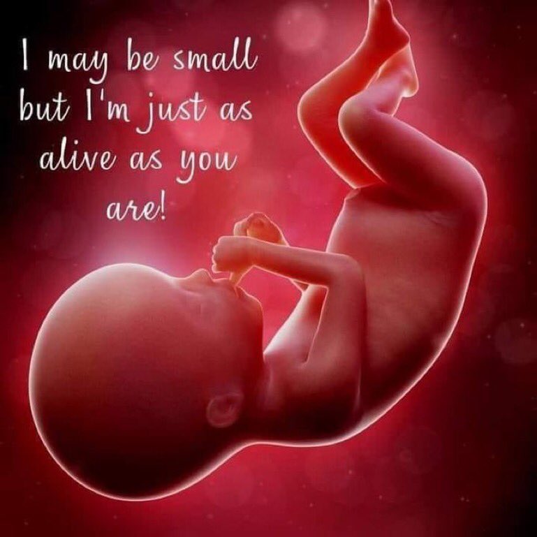 I AM PROLIFE. Protect the unborn. Abortion is the termination of a pregnancy by removal or expulsion of an embryo or fetus. @827js @cmir_r @Pixie1z @RnkSt7 @Outs45 @salis333 @fordmb1 @CJSzx12 @Ikennect @3Tony48 @HPY2KW @ToniLL22 @LindaNTx @Chloe4Djt @TrumpLola
