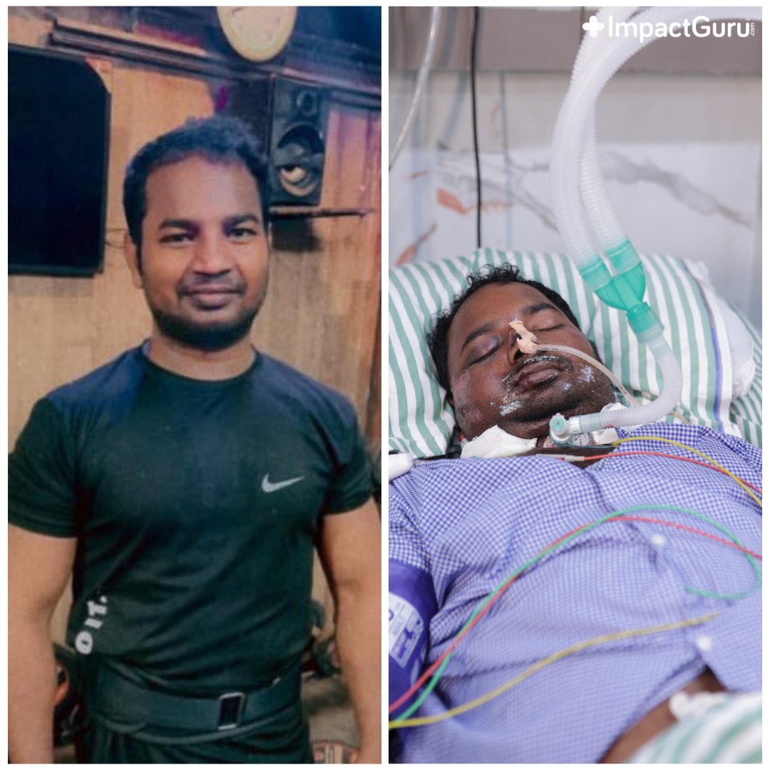 Jitendra’s life is hanging by a thread as he met with a serious road accident. He’s now unconscious in the hospital suffering from multiple injuries. His wife Rajni fears she might lose the love of her life! Save Jitendra’s precious life: bit.ly/44KyKLL #Help #Save