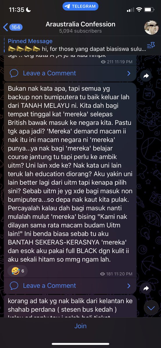 limberryy's tweet photo. @akmalaizad_ kelakor https://t.co/ML4WJe3ahI