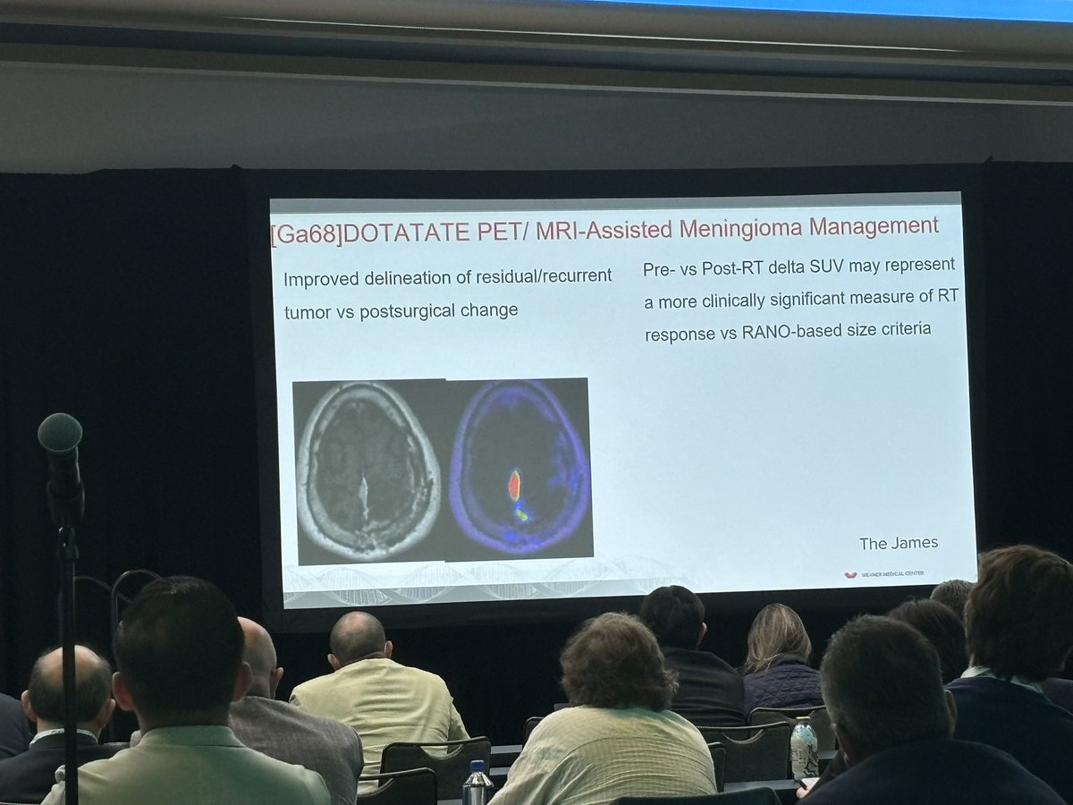 Excellent talk by @joshuapalmermd showing the benefits of DOTATATE PET to guide management of meningiomas. Fantastic images showing where/when MRI is inferior to PET #ISRSUSA2024 @ISRSy