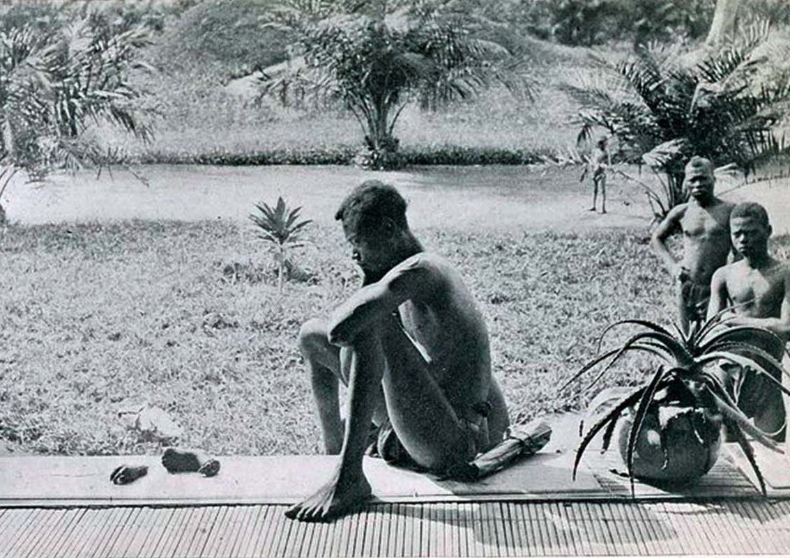 A father stares at the hand and foot of his five-year-old daughter, severed as a punishment for having harvested too little rubber, Congo under King Leopold II, 1904.