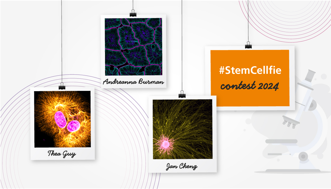 The submissions for this year's #StemCellfie Contest are out-of-this-world! 🛸📷

Our online gallery is now live. Browse through our page to find your favorite #cellfie or look for inspiration for next year's contest: bit.ly/3xUy0HJ