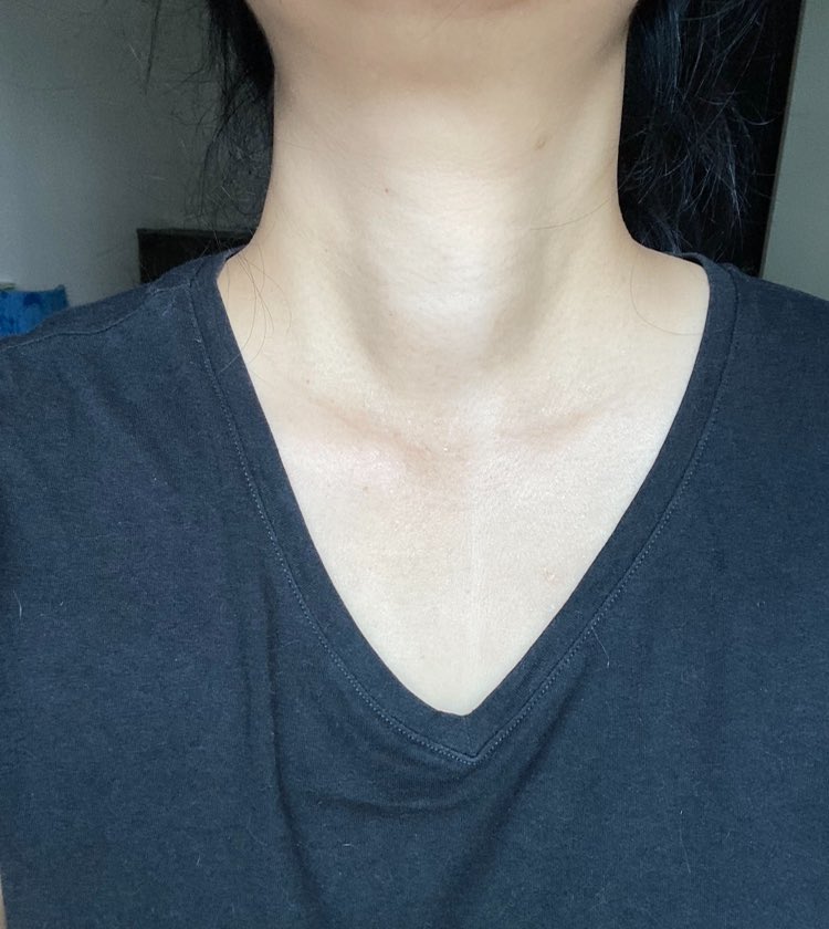 NᵔoᵔKkY(=^ᴥ^=) tweet media