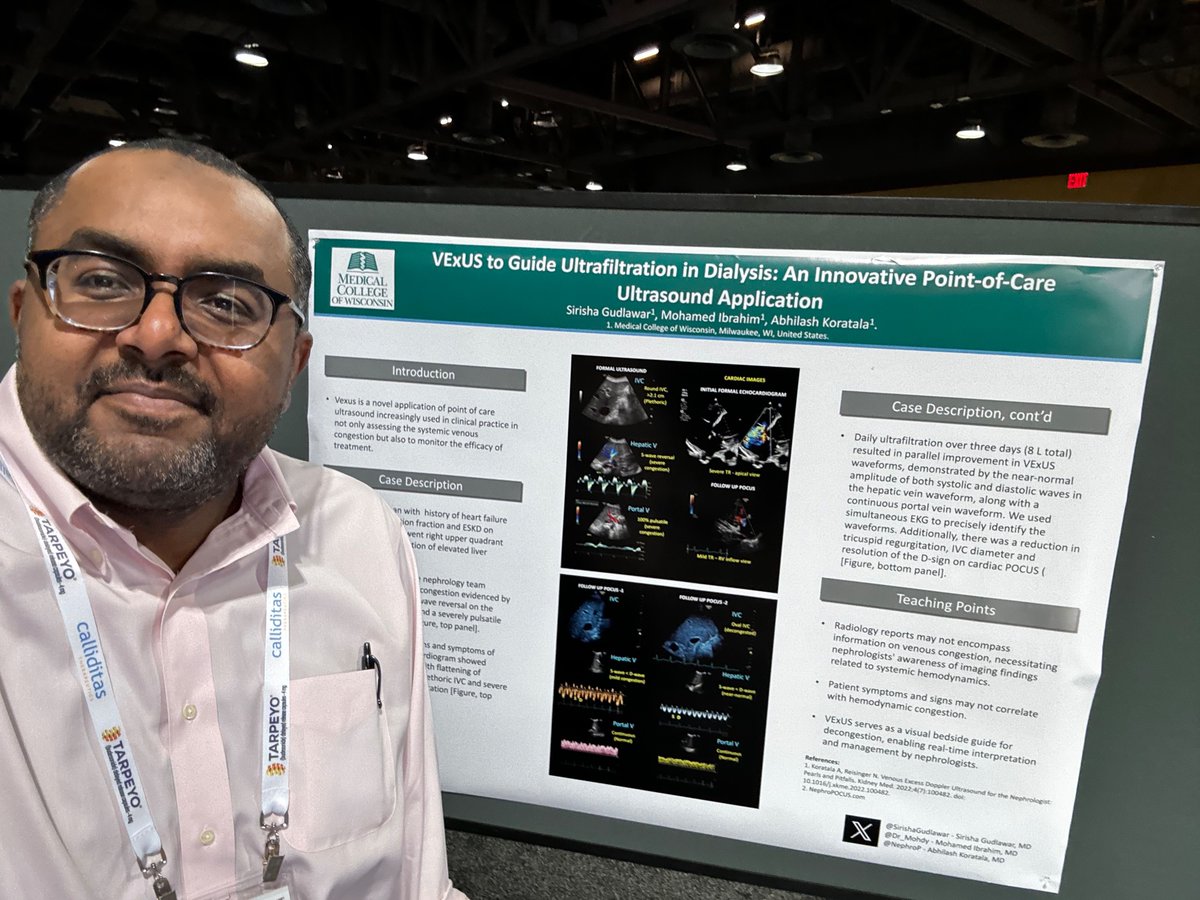 Our #Nephrology fellow <a href="/Dr_Mohdy/">Mohamed Ibrahim, MD</a> presents his poster at #NKFClinicals, co-authored with <a href="/SirishaGudlawar/">Sirisha Gudlawar</a>, illustrating how #POCUS for volume (hemodynamic) assessment includes much more than just the IVC.