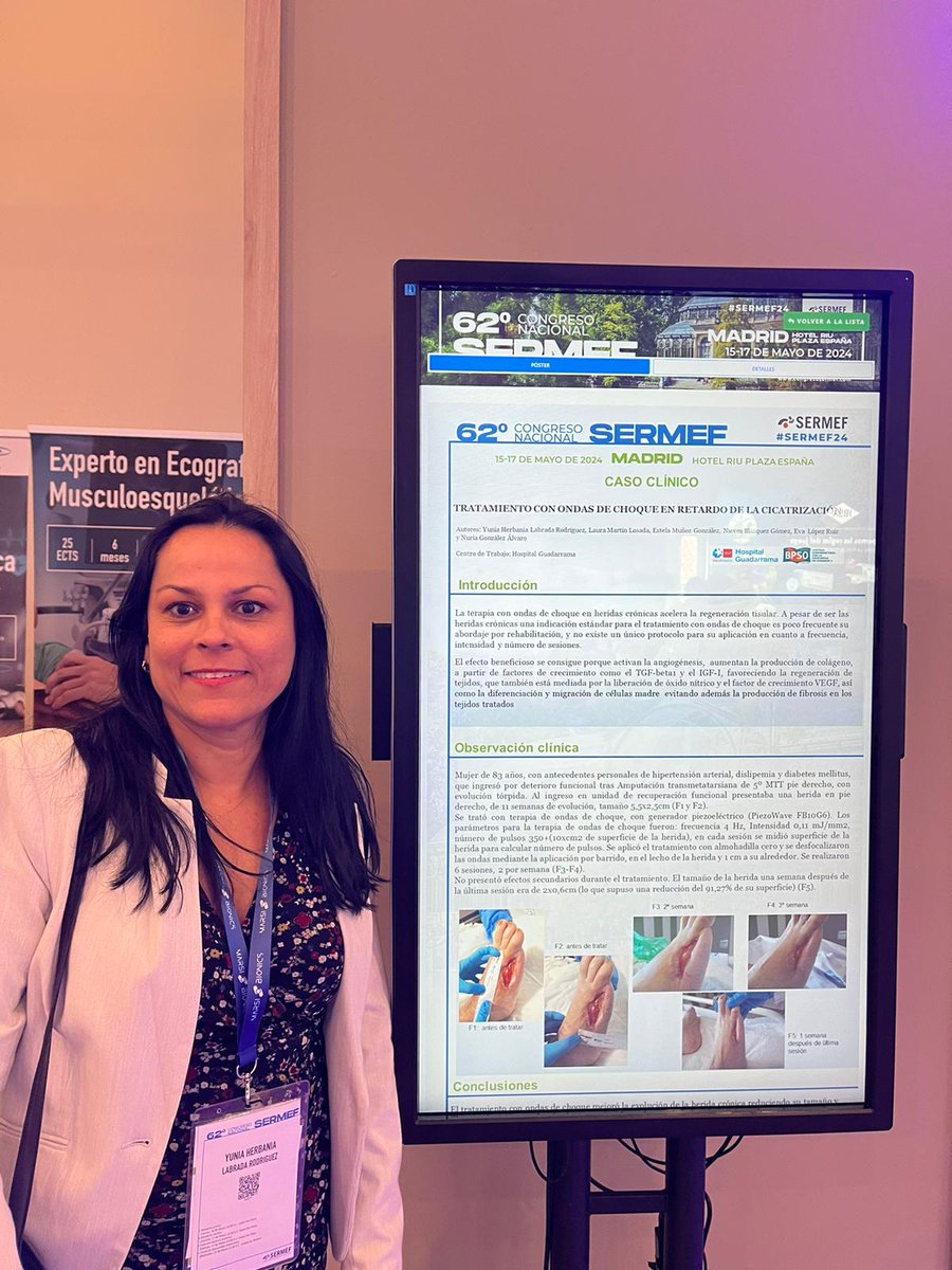 Caso clínico en #SERMEF24 sobre tratamiento con ondas de choque en el #Hospitalguadarrama 
#Shockwavetherapy in #chronicwounds de la mano de la Dra. Yunia Labrada. <a href="/RNAO/">RNAO</a> <a href="/BPSOspain/">BPSO</a> <a href="/ANDEorg/">ANDE Directivos Enfermería</a> <a href="/CGEnfermeria/">Consejo General de Enfermería</a> <a href="/montsolis282/">Montserrat Solís</a> <a href="/Stela_mu/">Estela Muñoz</a> <a href="/santihgua/">Santi Alonso</a> @PCuidarte21999