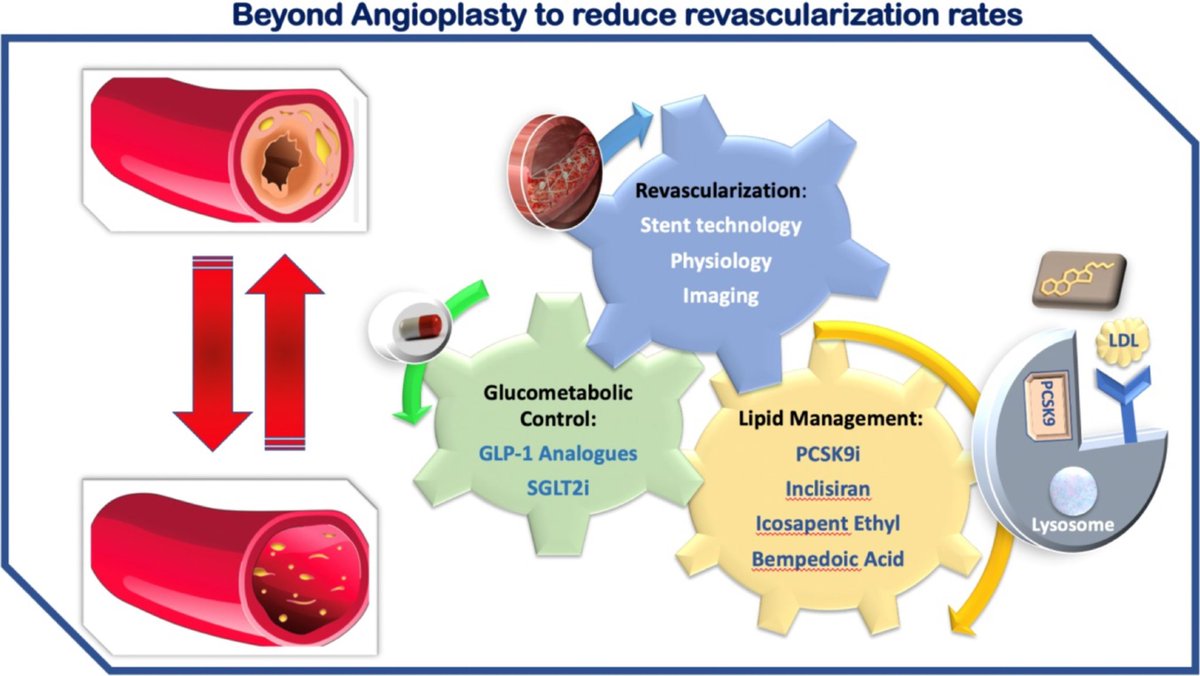 🔴New approaches to reduce recurrent PCI: to angioplasty and beyond! #openaccess academic.oup.com/ehjopen/articl… #medtwitterWhat #MedTwitter #CardioEd #medx #medEd #CardioTwitter #cardiotwitter #MedX #MedEd #cardiology #cardiotwiteros #FOAMed #medicine #cardiox #medical