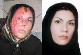 Suomalaisillahan on aina ollut tapana heittää happoa vaimon naamaan. 

Kun Googlettaa ”Acid attack”, montako hijabipäistä naista näet? 🫣