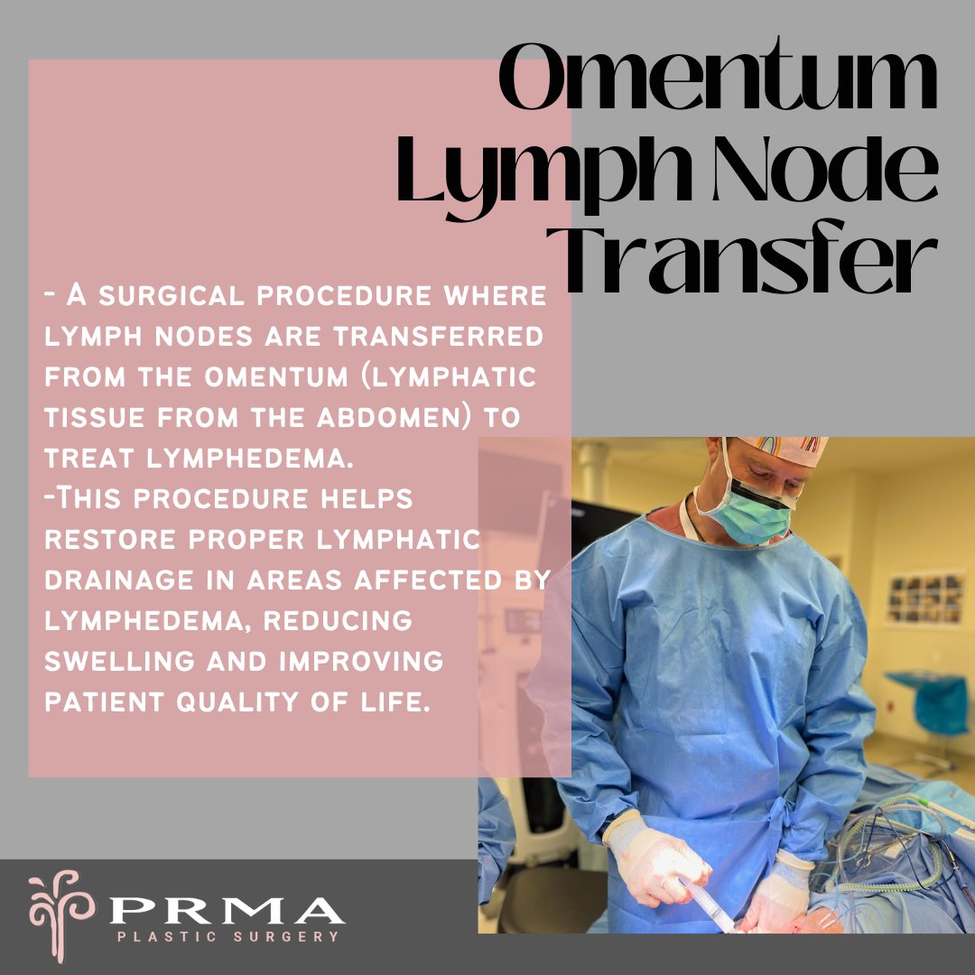 🔬✨ A surgical procedure where lymph nodes are transferred with the omentum flap to treat lymphedema. This  approach offers new hope for patients suffering from chronic lymphatic issues due to Breast Cancer. 🏥 #Lymphedema  #HealthcareAdvancements 🔗 bit.ly/3aOittp