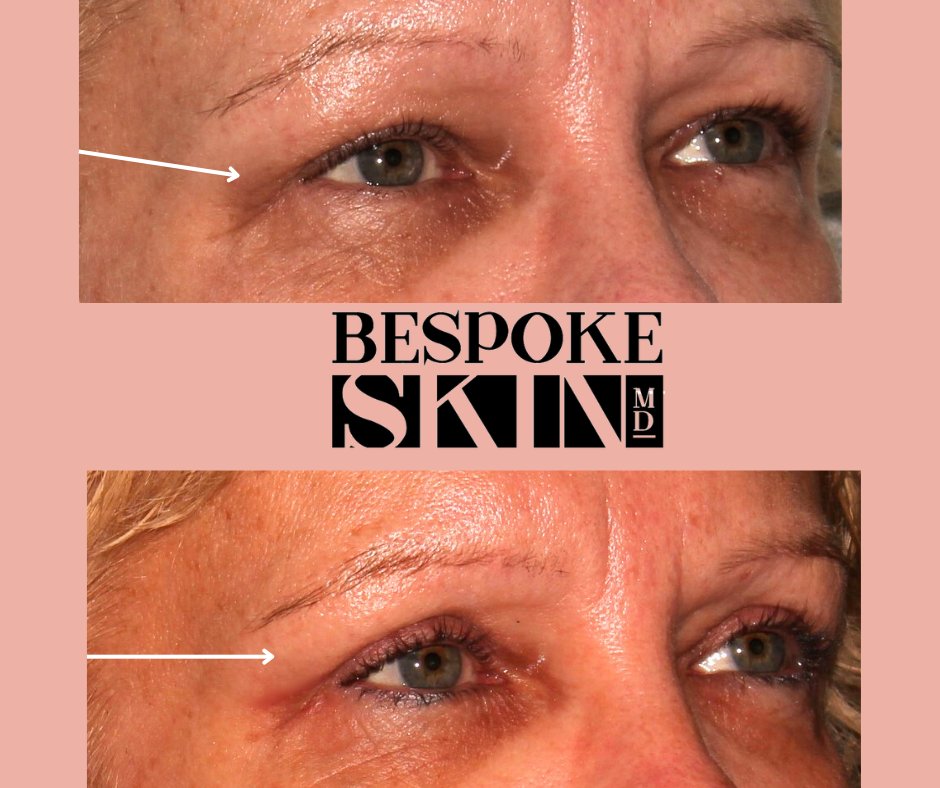 Bespoke Skin MD tweet media