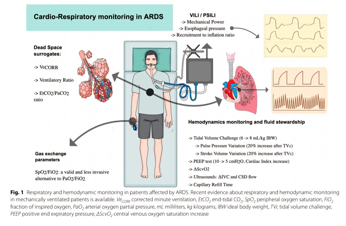 🔴Recent advances in cardiorespiratory monitoring in ARDS patients #openaccess #2024Review jintensivecare.biomedcentral.com/articles/10.11… #medtwitterWhat #MedTwitter #CardioEd #medx #medEd #CardioTwitter #cardiotwitter #MedX #MedEd #cardiology #cardiotwiteros #FOAMed #medicine #cardiox #medical