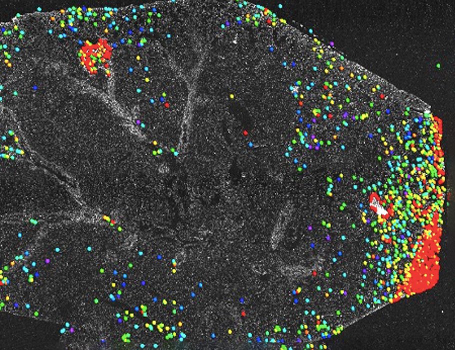 Waggoner Lab (@labwaggoner) on Twitter photo Tumor-associated NK cells induce myeloid-derived suppressor cells to suppress antitumor T cell responses <a href="/ScienceTM/">Science Translational Medicine</a> Congrats, <a href="/DrNeosy/">Neo Shi Yong</a> & <a href="/LundqvistLab/">Lundqvist Lab</a>
science.org/doi/10.1126/sc… Tumor-associated NK cells induce myeloid-derived suppressor cells to suppress antitumor T cell responses <a href="/ScienceTM/">Science Translational Medicine</a> Congrats, <a href="/DrNeosy/">Neo Shi Yong</a> & <a href="/LundqvistLab/">Lundqvist Lab</a>
science.org/doi/10.1126/sc…