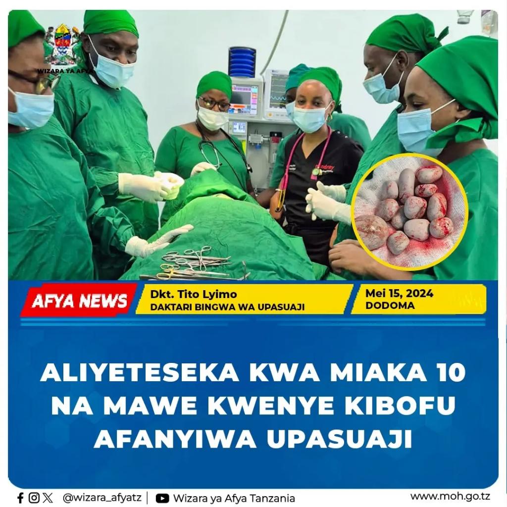 ALIYETESEKA KWA MIAKA 10 NA MAWE KWENYE KIBOFU AFANYIWA UPASUAJI Na WAF - Dodoma Madaktari bingwa wa Rais Samia wamefanikiwa kutoa mawe kwenye kibofu cha mkojo cha Bw. Leonard Mhunda Mkazi wa Chamwino Mkoani Dodoma ambayo yalimtesa kwa takriban miaka 10. Akizungumza mara