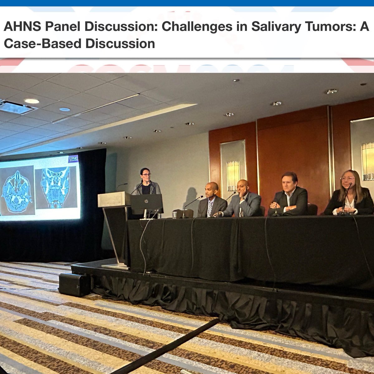 Challenges in Salivary Tumors: Case-Based Discussion with moderator Jessie Maxwell, MD, MPH and panelists Kiran Kakarala, MD; William Ryan, MD; Shaum Sridharan, MD; Mirabelle Sajisevi, MD
<a href="/AHNSinfo/">AHNS</a> <a href="/__COSM/">COSM</a> #cosm2024 #ENTsurgery #WeAreOto #OtoHNS #OHNS #MedEd #AHNS2024 #MedTwitter