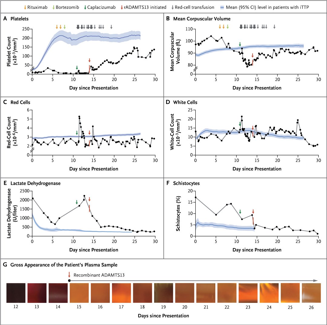 Brief Report: Recombinant ADAMTS13 for Immune Thrombotic Thrombocytopenic Purpura nej.md/4b77CsZ 

#AutoimmuneDisease