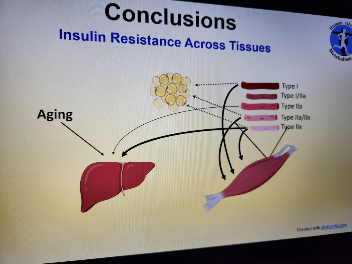 Sharing research from our lab linking #insulinresistance to different types of #musclefibers @EASOobesity meeting in Venice. #ECO2024 was a great experience!