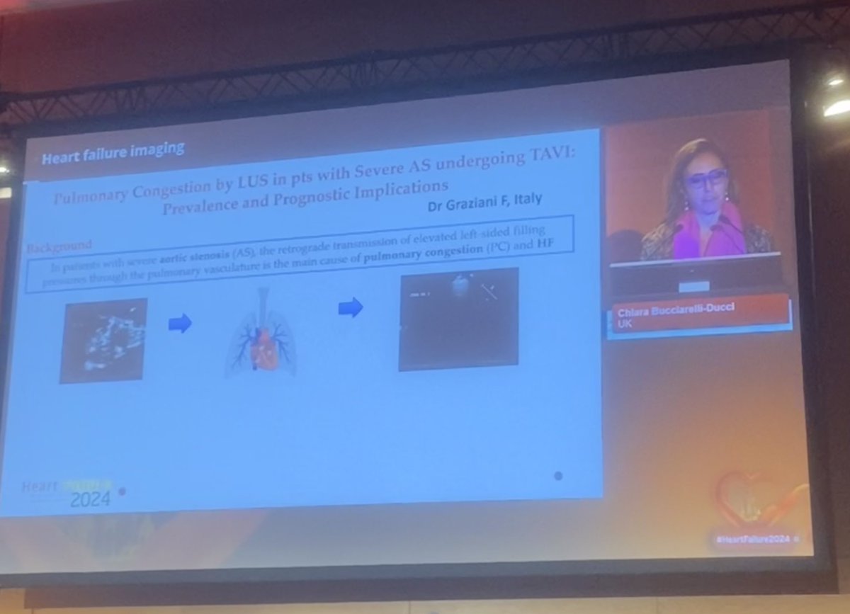 Giulia Iannaccone (@giuliaiannacco2) on Twitter photo Our study about LUS in pts with severe aortic stenosis undergoing TAVI mentioned in the #HeartFailure2024 highlights session!
Congratulations to the whole team👏🏻
<a href="/FGraziani_Grace/">francesca graziani_FG</a> <a href="/RosaLillo14/">Rosa Lillo</a> <a href="/stefano_cangemi/">Stefano Cangemi</a> <a href="/Antonel42509993/">Antonella Lombardo</a> <a href="/BURZOTTA_F/">FRANCESCO BURZOTTA</a> Our study about LUS in pts with severe aortic stenosis undergoing TAVI mentioned in the #HeartFailure2024 highlights session!
Congratulations to the whole team👏🏻
<a href="/FGraziani_Grace/">francesca graziani_FG</a> <a href="/RosaLillo14/">Rosa Lillo</a> <a href="/stefano_cangemi/">Stefano Cangemi</a> <a href="/Antonel42509993/">Antonella Lombardo</a> <a href="/BURZOTTA_F/">FRANCESCO BURZOTTA</a>