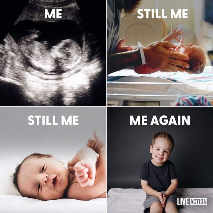 My life is valuable at ALL stages!❤🙏💯💜 #ChooseLiFE