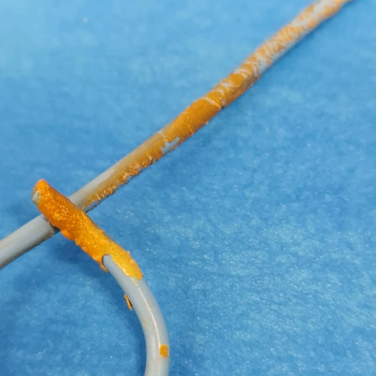 teodicapua's tweet photo. Could someone explain what is the most effective method to avoid these catheter encrustations other than removing them as soon as possible?
some magic potion?
#endourology
#urinarystonedisease
#lasertreatment
#hospitalcima
#hospitaluniversitaridexeus
#hospitalsanrafael https://t.co/7sf4pmy5az