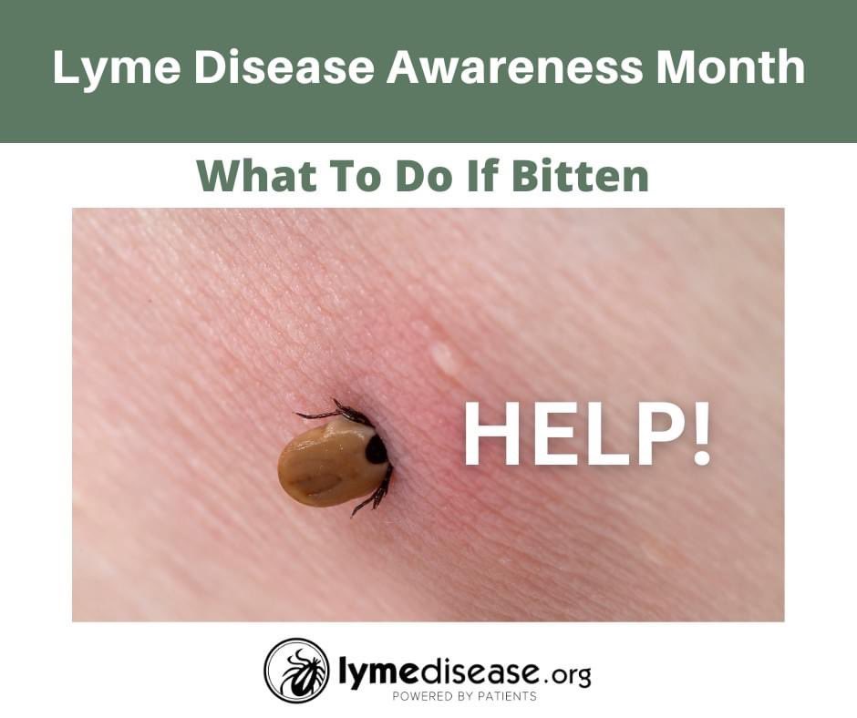 Lymenews's tweet photo. "DO NOT squeeze, twist or squash the tick. Don’t burn it with a match or cover it with Vaseline or nail polish. Squeezing or agitating the tick may force it to expel more pathogens into your body." 
READ MORE: https://t.co/021uftEPD1 #ticks #LymeDiseaseAwarenessMonth https://t.co/BNBI9nmfa2