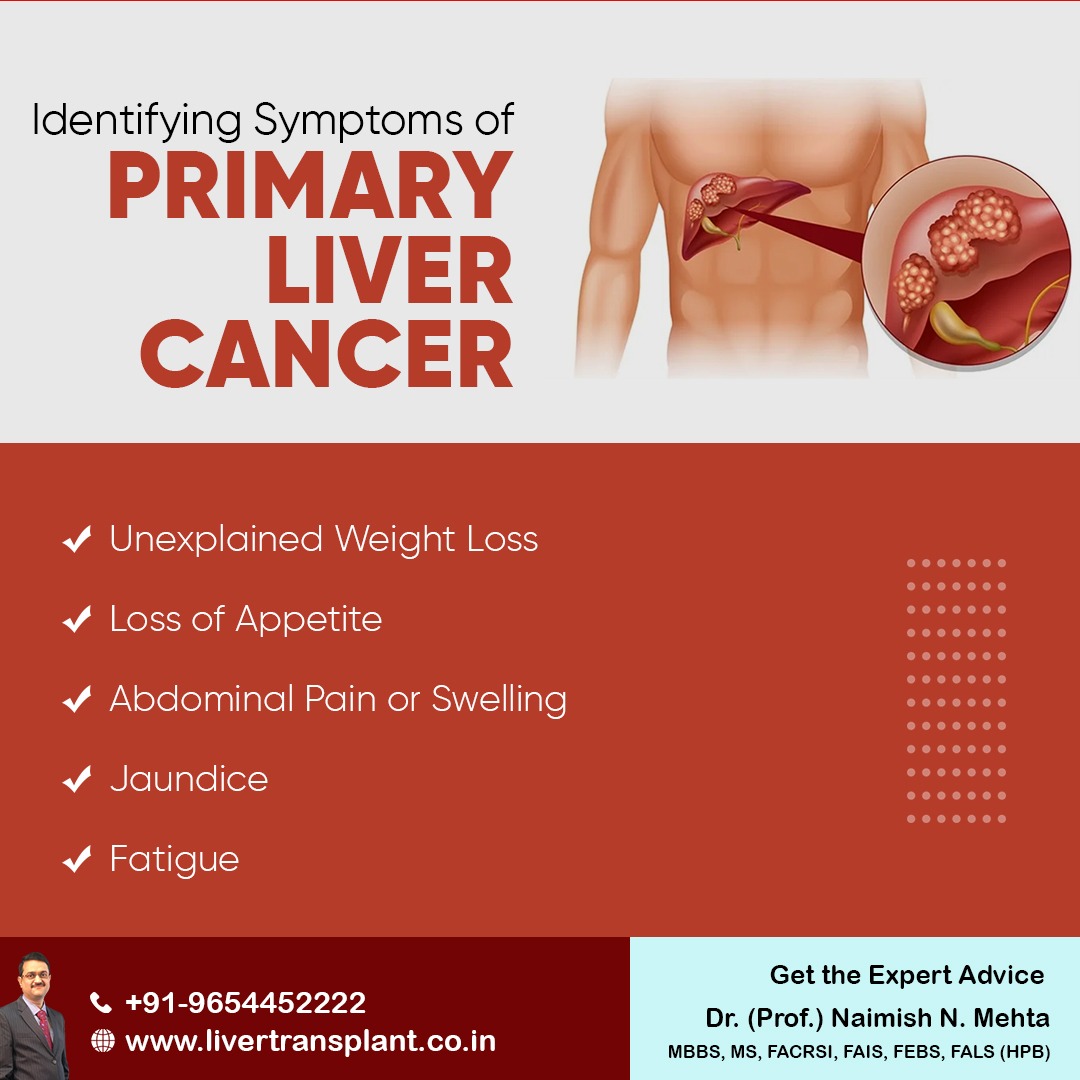 mehta_naimish's tweet image. Identifying Symptoms of Primary Liver Cancer:
- Unexplained Weight Loss
- Loss of Appetite
- Abdominal Pain or Swelling
- Jaundice
- Fatigue

#livercancer #liverproblem #liverdisease #liverpain #liverdoctor #DrNaimishMehta