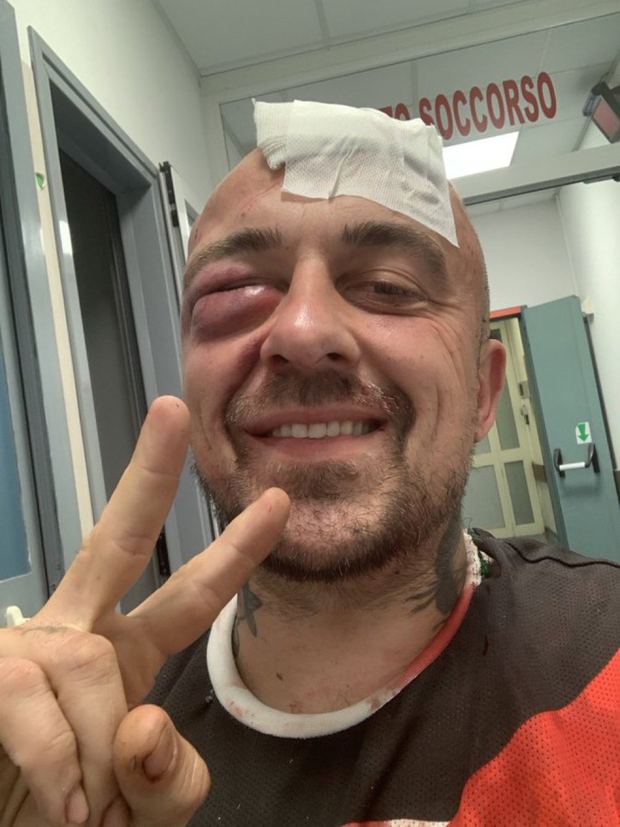 🚨BREAKING: In Italy, Famous Italian chef Gabriele Rubini, known as Chef Rubio, criticized the suppression of dissent against genocide in Gaza. Following his remarks, Chef Rubio was violently attacked by six Zionists outside his home in Rome last night.