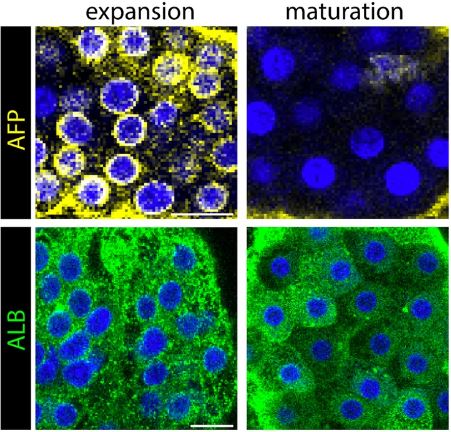 Researchers characterized 🧫 hepatocyte #organoid outgrowth! 🤰 Fetal #hepatocytes initiated reciprocal transcriptional programs involving increased proliferation and repressed lipid metabolism upon initiation of organoid growth. 📖 @NatureComms | go.nature.com/4bDoMOO