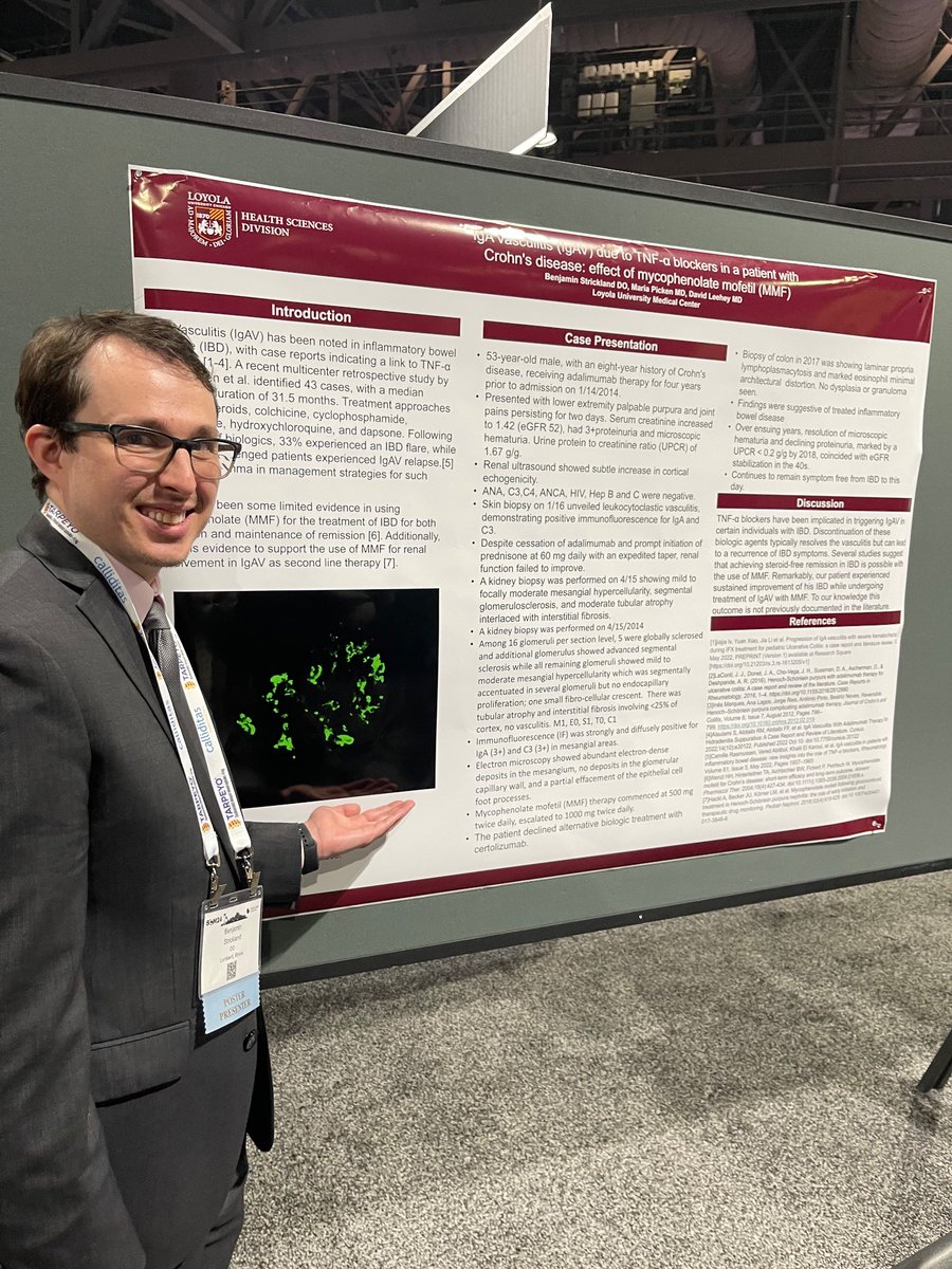 Dr Ben Strickland from @LoyolaNeph discusses humira and CKD at #NKFClinicals
