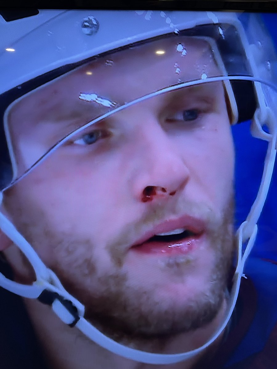 Not sure why the Tanev penalty was not a double minor.... there was obvious blood coming from Rantanen's nose #Avs #GoAvsGo    @TheRinkColorado