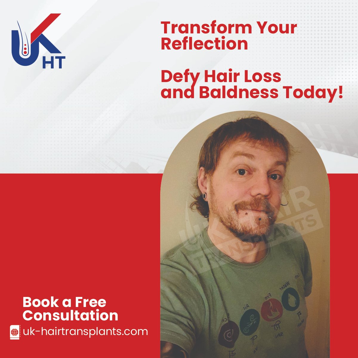 Regain your confidence and redefine your look with our effective solutions to combat hair loss and baldness! 💇‍♂️✨ Say hello to a new chapter of self-assurance and vitality. 

#HairLossSolution #BaldnessNoMore #ConfidenceRestored #HairRestoration #NewBeginnings