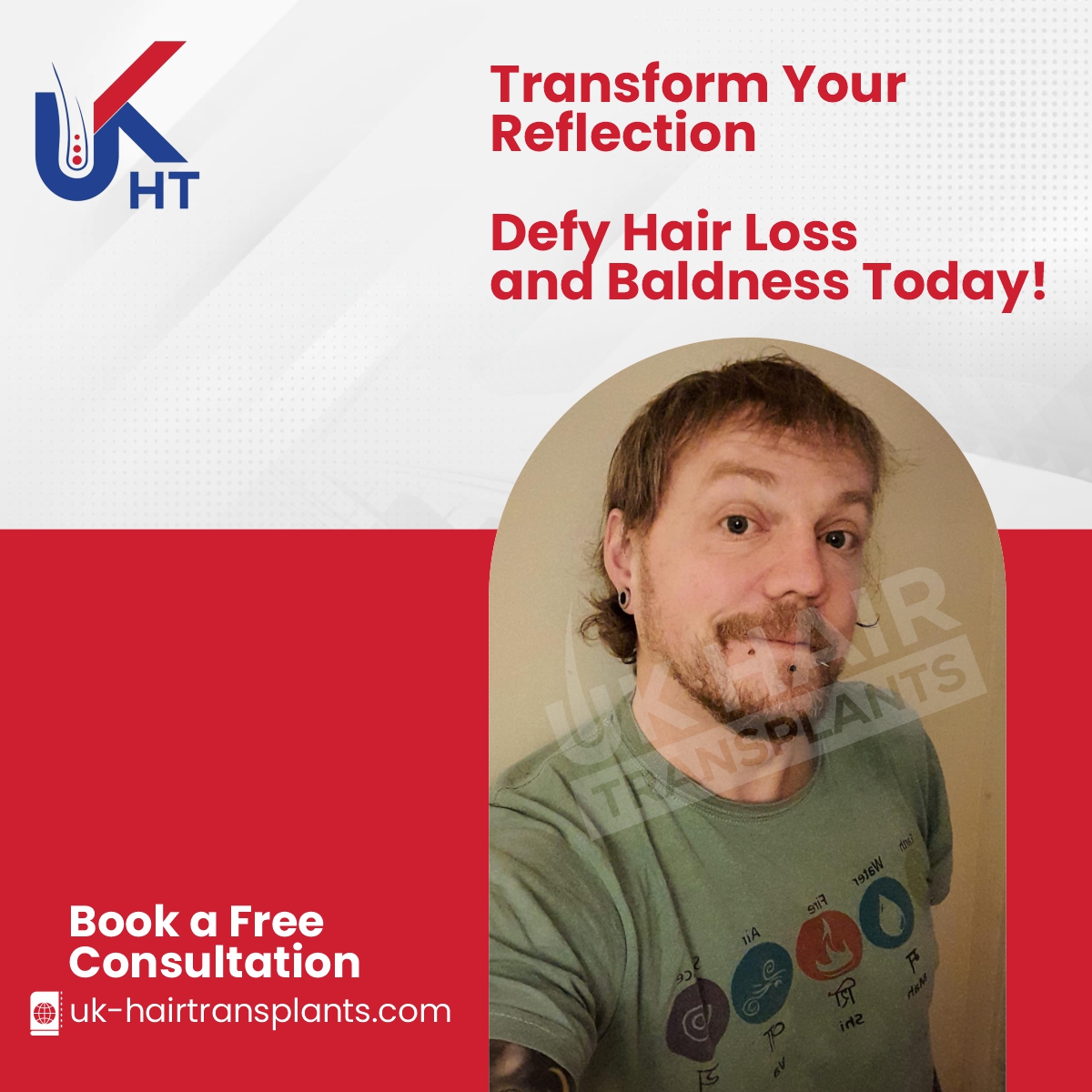 Regain your confidence and redefine your look with our effective solutions to combat hair loss and baldness! 💇‍♂️✨ Say hello to a new chapter of self-assurance and vitality.

#HairLossSolution #BaldnessNoMore #ConfidenceRestored #HairRestoration #NewBeginnings