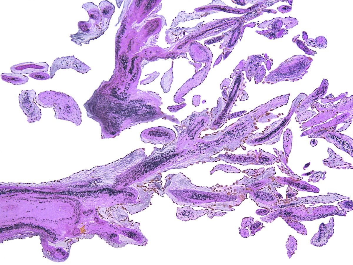 Pathology Walker@Auto Tweet Bot tweet media