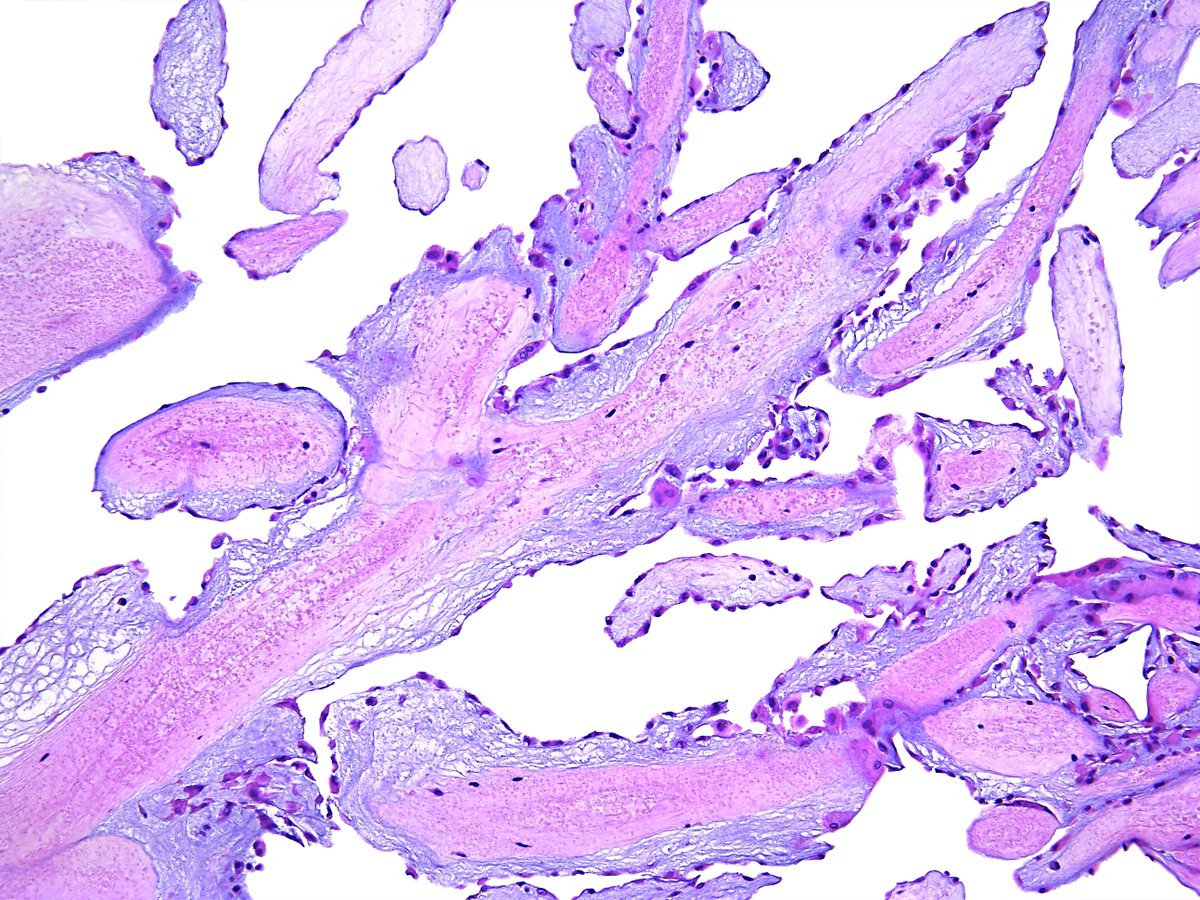 Pathology Walker@Auto Tweet Bot tweet media