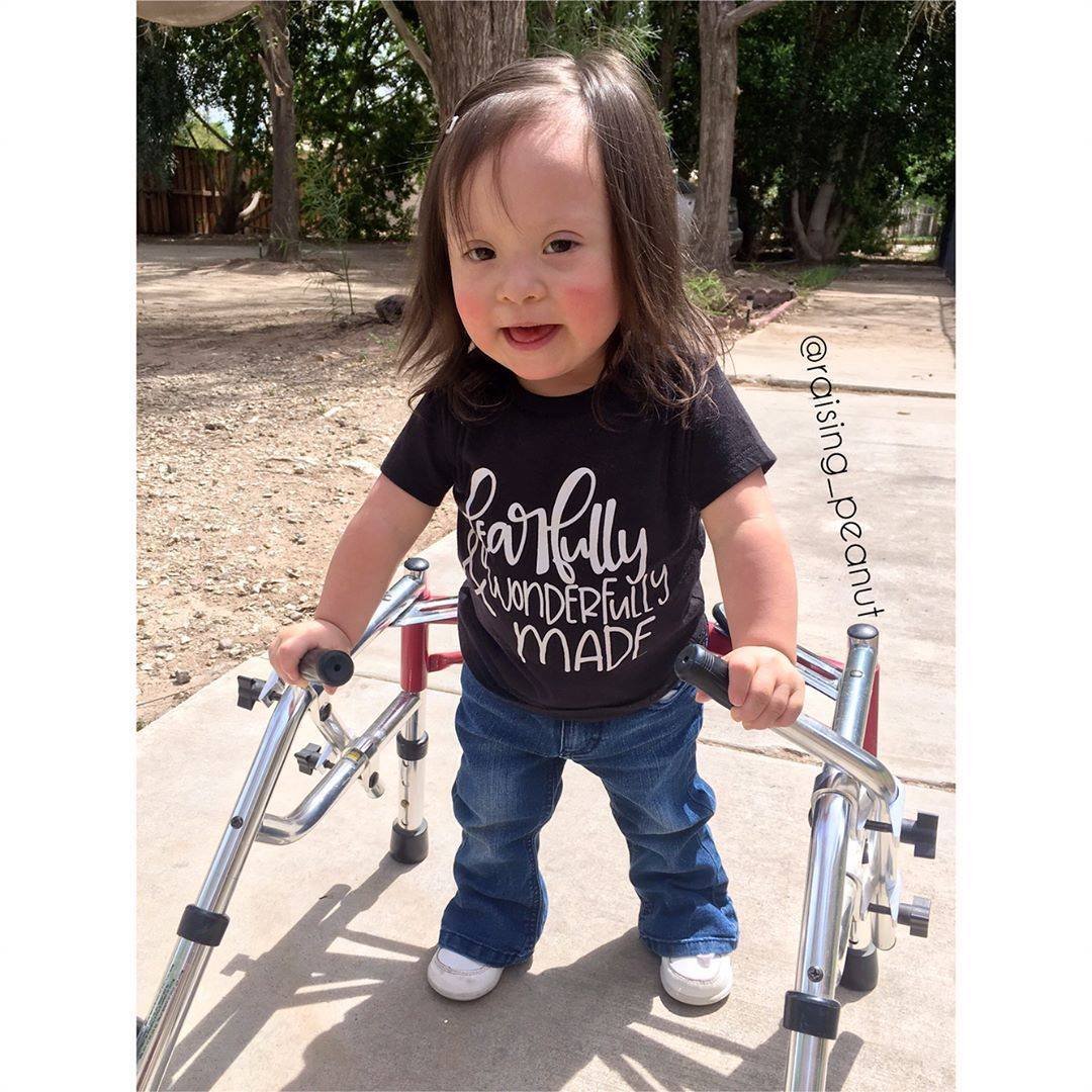 Against all the odds, little Peanut learns to walk all by herself. What a brave and adorable little fighter!