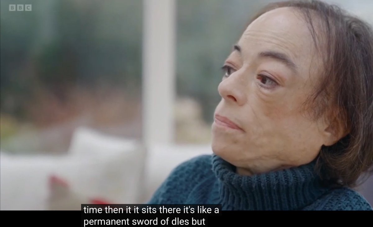 @thelizcarr this is exactly how I feel about qualifying for MAiD all the time: permanent sword of Damocles the MAiD advocate she’s speaking to asks about her right to not wait until she’s terminally ill to easily access MAiD, because it would save her from pain Carr’s reply doesn’t miss a