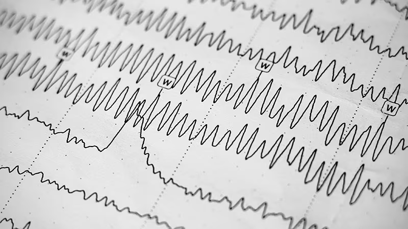 Two new drugs are headed toward pivotal trials after making their endpoints in phase 2 treatment-resistant epilepsy studies. ms.spr.ly/6014YX0Za