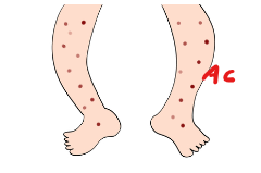 「feet toes」 illustration images(Latest)