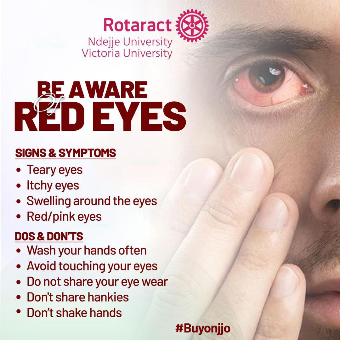 RotaractClubVU's tweet image. Be vigilant 
#Buyonjjo 
#WashForAll