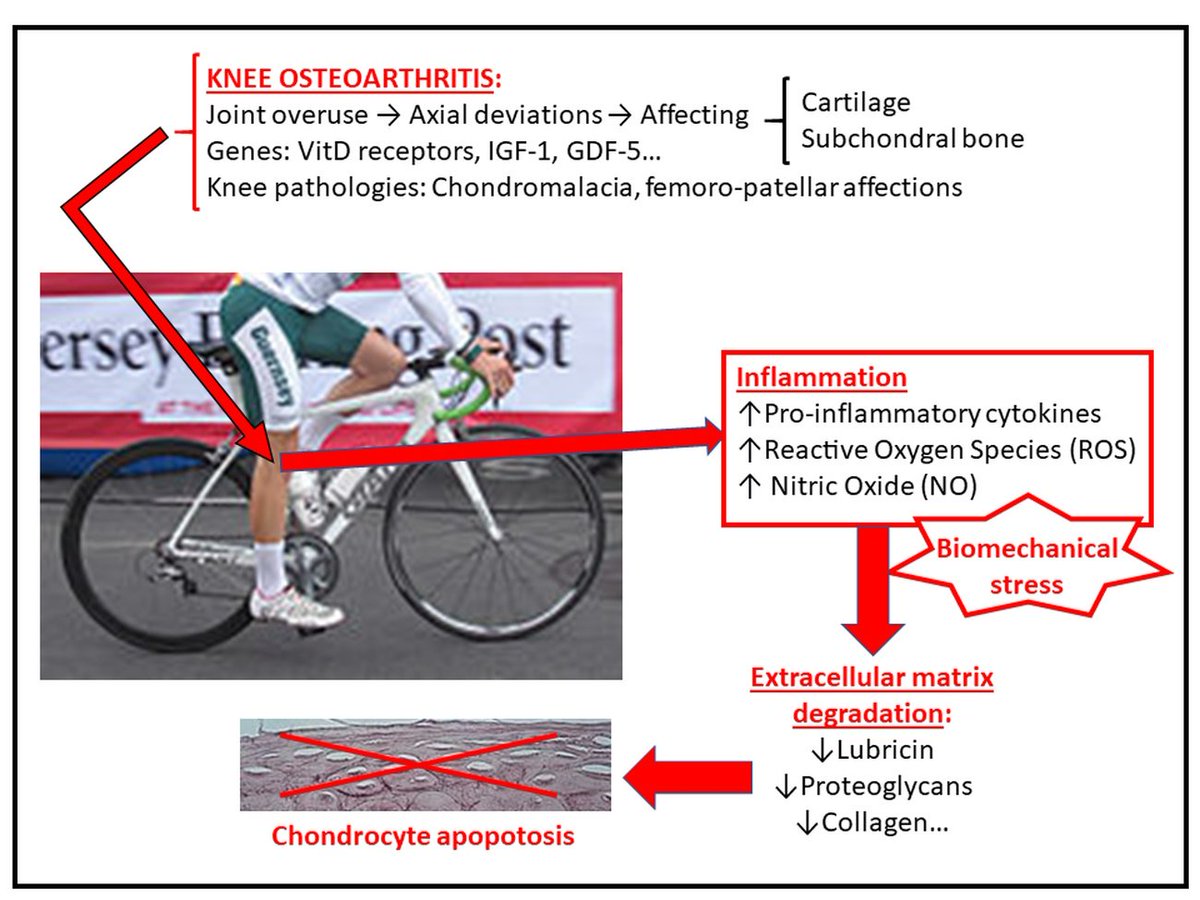 🔓| Call for Reading Title: Inflammatory Process on Knee Osteoarthritis in Cyclists 🆔DOI: 10.3390/jcm12113703 🔗Fully available at: mdpi.com/2314044 @UVa_es @UniversidadMH #joint #Osteoarthritis #bone