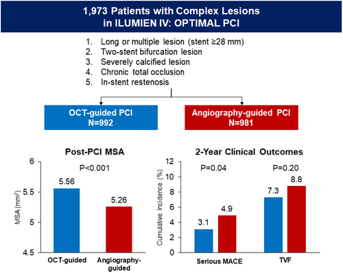 In a substudy of the ILUMIEN IV randomized trial focusing on patients with complex angiographic lesions, OCT-guided PCI led to a larger MSA and reduced the rate of cardiac death, target-vessel MI, or stent thrombosis compared with angiography-guided PCI at 2 years (p=0.04), but
