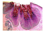 Biomedres01's tweet photo. The Flourishing Miasma-Molluscum Contagiosum by Anubha Bajaj in #BJSTR
https://t.co/6IOQiaBaSA https://t.co/hc91tTdIgc
