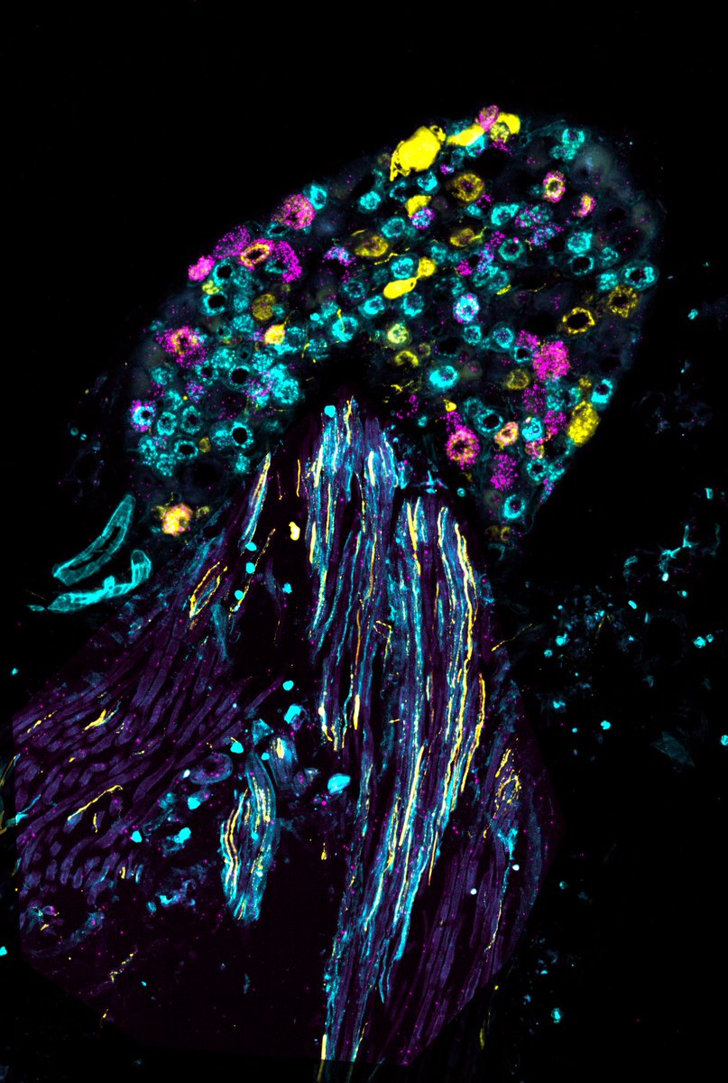 Manx Neurobiologist (@garyrlewin1) on Twitter photo <a href="/MDC_Berlin/">Max Delbrück Center</a> <a href="/helmholtz_image/">Helmholtz Imaging</a> @CosciaLab <a href="/holger_gerhardt/">Holger Gerhardt</a> Well done Thanos and Lin! Two best image prizes in the bag with the DRG jelly fish <a href="/MDC_Berlin/">Max Delbrück Center</a> <a href="/helmholtz_image/">Helmholtz Imaging</a> @CosciaLab <a href="/holger_gerhardt/">Holger Gerhardt</a> Well done Thanos and Lin! Two best image prizes in the bag with the DRG jelly fish