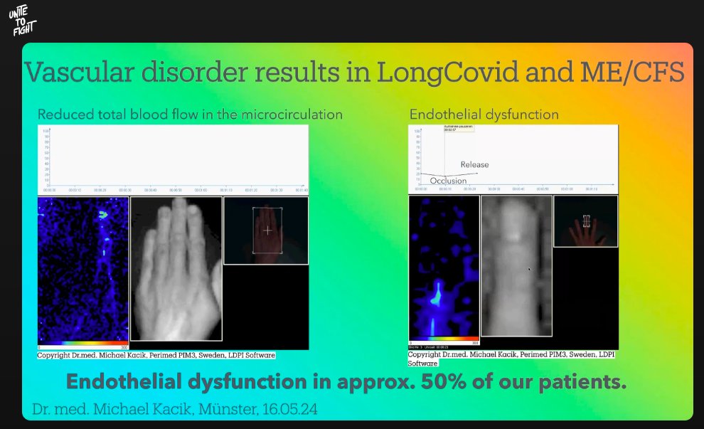 Dr Michael Kacik talks about vascular disorder. Post infection diseases, including Long COVID and MECFS show vascular disorders in the endothelium. Vascular therapy improves multiple symptoms. #UniteToFight2024