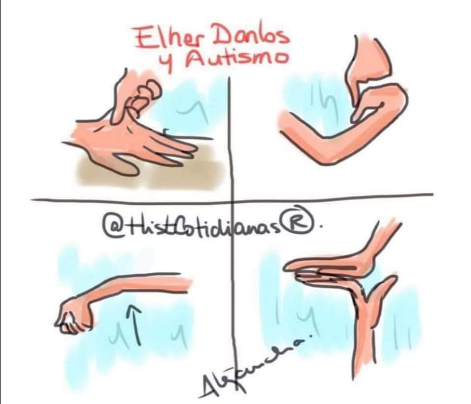 Abro hilo corto🧵sobre la relación que existe entre autismo y Síndrome de Ehlers-Danlos (S.E.D.)⤵️

#EhlersDanlos #SindromeEhlersDanlos #15Mayo #DiaMundialSindromeEhlersDanlos #SoyAutista #autista #autismo #hiperlexitud