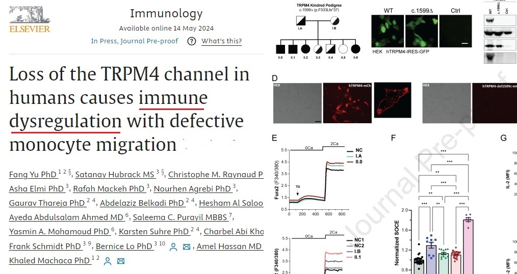. the 1⃣st human cases 🧬 with complete loss of the TRPM4 channel leading to ➡️ immune dysregulation with frequent bacterial and fungal 🦠infections sciencedirect.com/science/articl… #immunology
