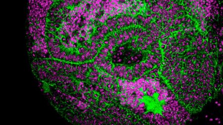 .@IRBBarcelona Dos genes de la línea germinal son esenciales para el desarrollo de tumores cerebrales en Drosophila biotech-spain.com/es/articles/do…